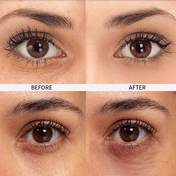 Undereye & Dark Circle Corrector